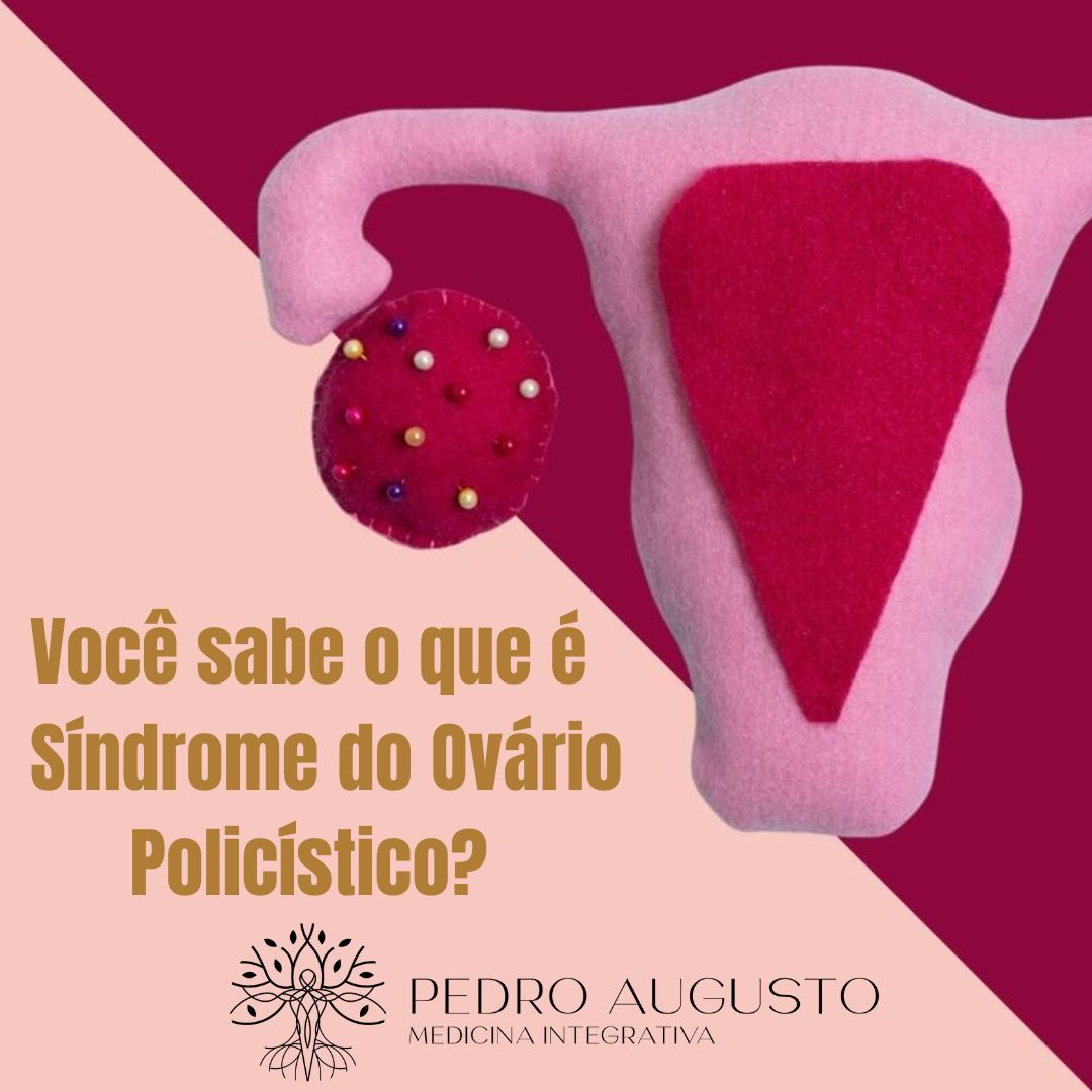 Ovário Policístico, sabe o que é? Venha se consultar com Dr. Pedro ...