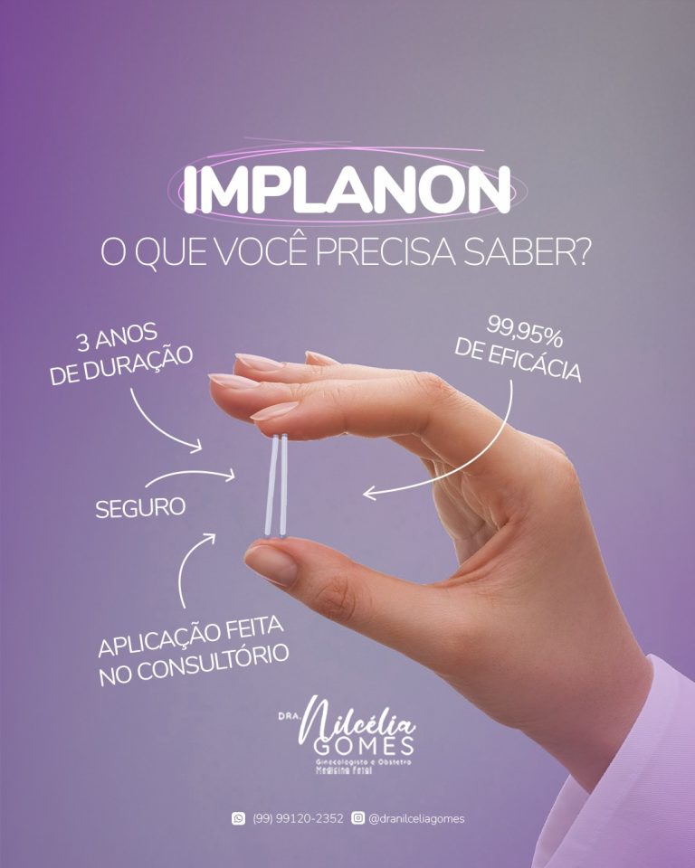 IMPLANON: Conheça esse método contraceptivo SUPER SEGURO – Blog do Acélio
